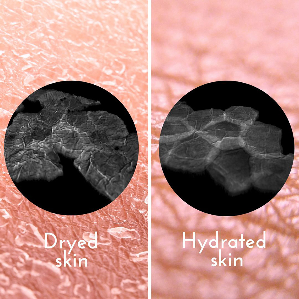 Skin hydration